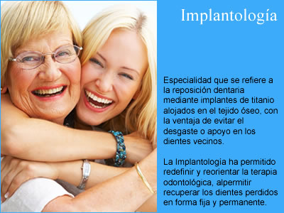 implantologia